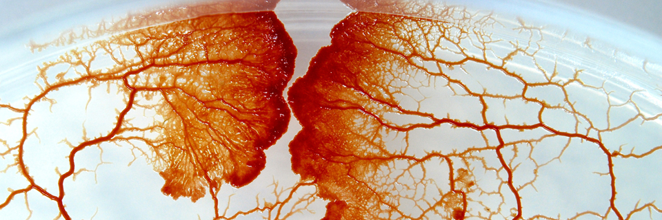 Physarum roseum アカモジホコリ